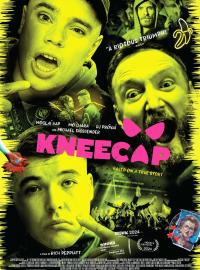 Kneecap